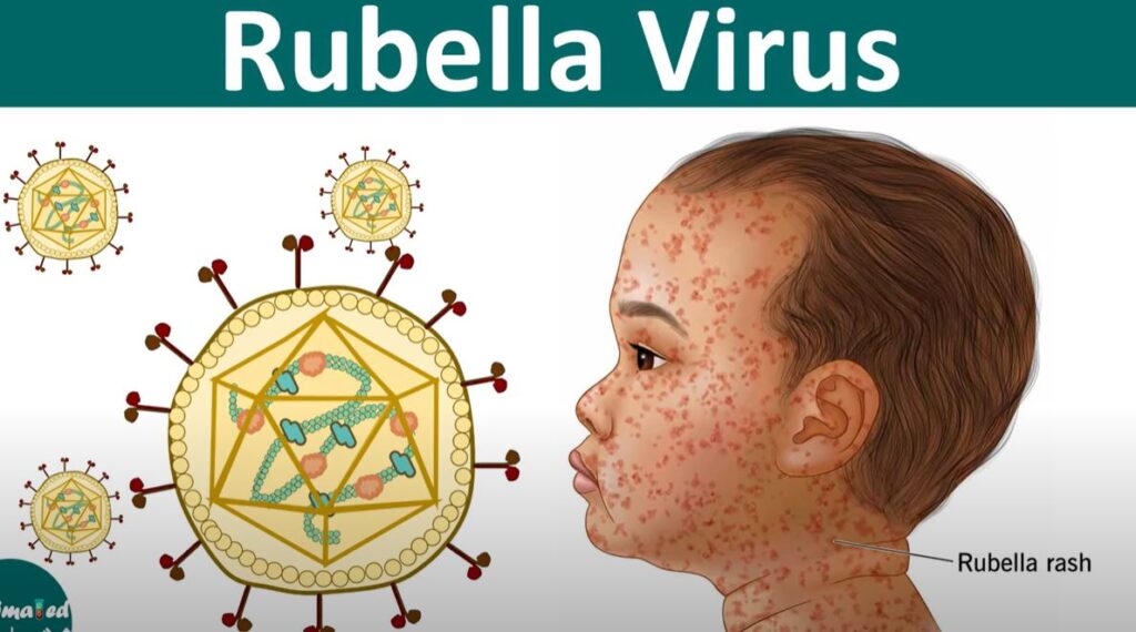 नेपालले रुबेला उन्मुलनमा सफलता पायो: डब्ल्यूएचओ दक्षिण-पूर्व एशिया क्षेत्रमा महत्वपूर्ण उपलब्धि