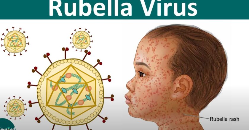 नेपालले रुबेला उन्मुलनमा सफलता पायो: डब्ल्यूएचओ दक्षिण-पूर्व एशिया क्षेत्रमा महत्वपूर्ण उपलब्धि